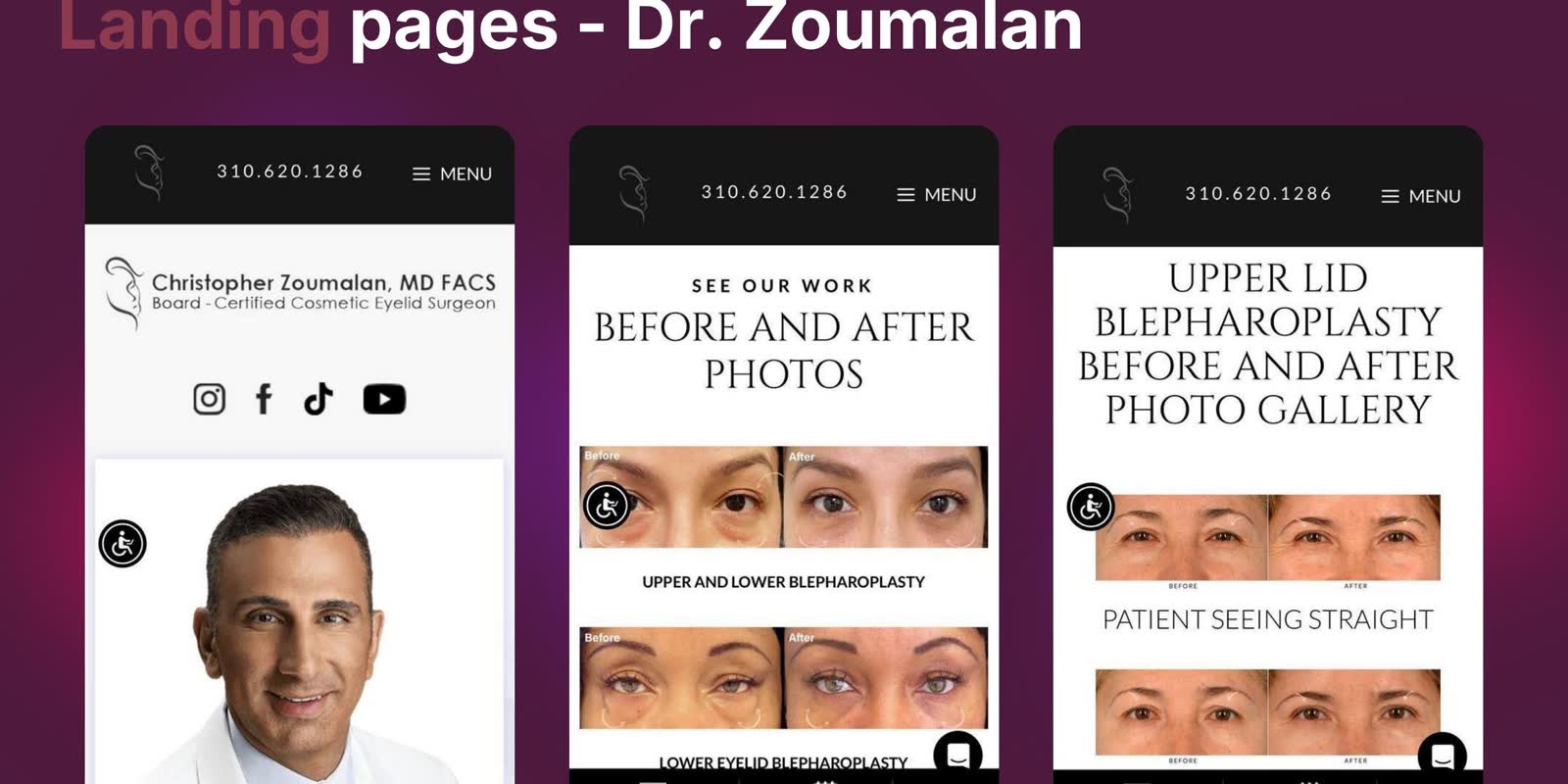 Dr. Zoumalan Landing Pages